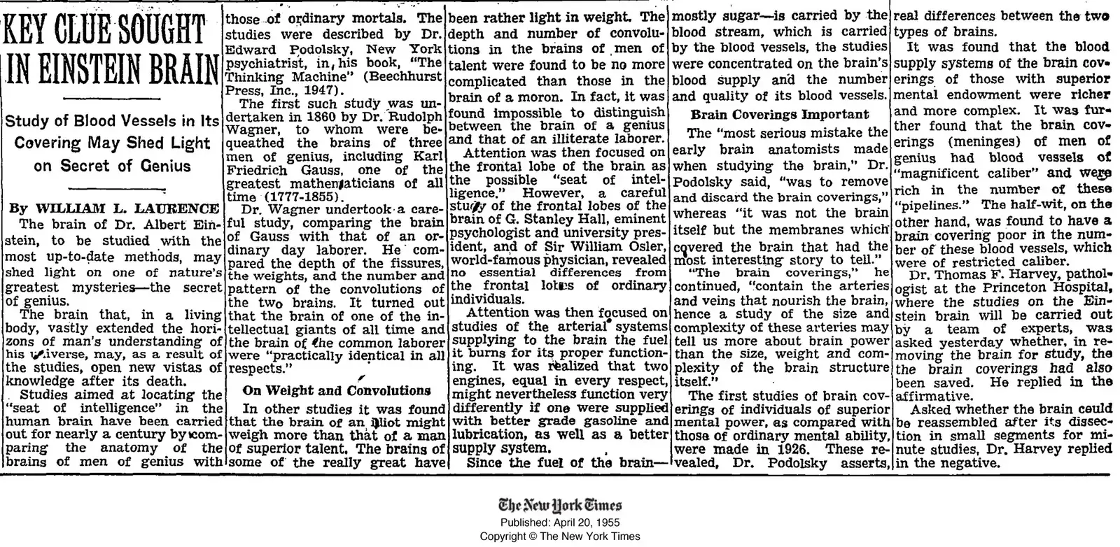 Einstein's brain stolen - NY Times news