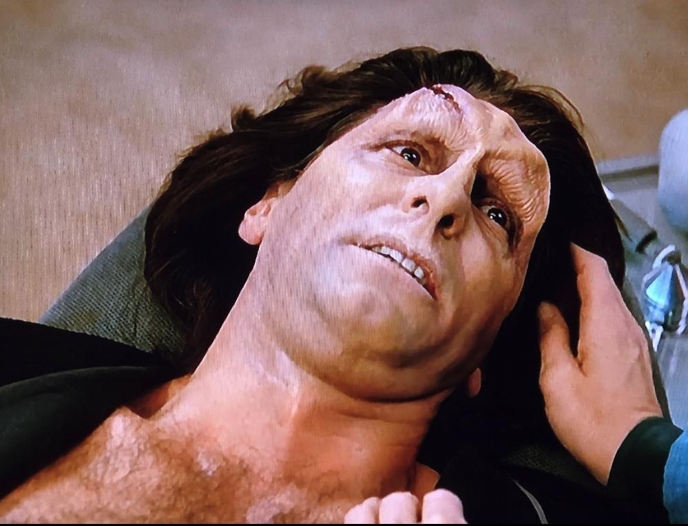 Dr. Crusher's boyfriend, a trill but looking way different than Trills we see later in DSN. He has ridges on his head and no skin leopard marks and shoulder length hair and a hairy chest. He lies dying on the med bed.
