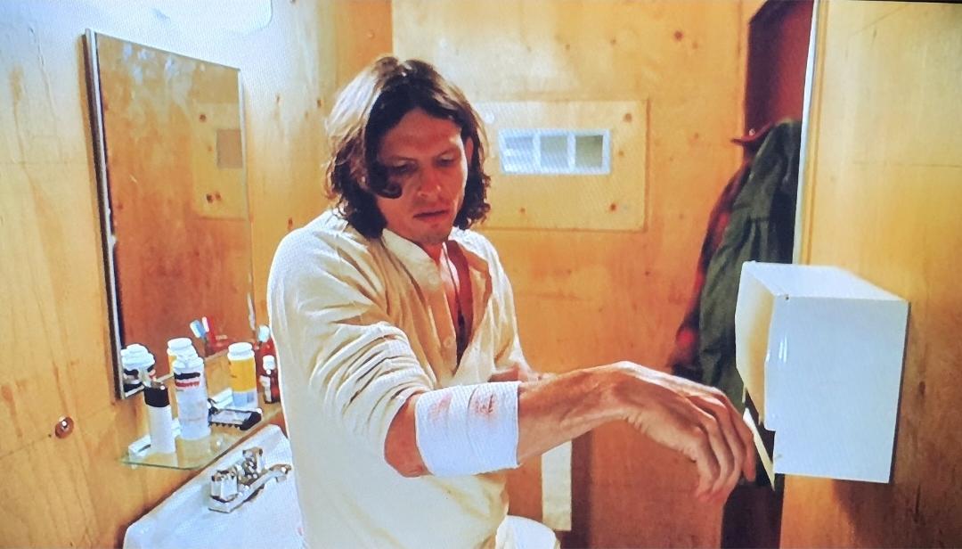 Jeff Kober probably in his 20s or early 30s.  He's in the bathroom with a bandage on a wound on his firearm. Behind him sink and disinfectant and beside him is a paper towel dispenser.